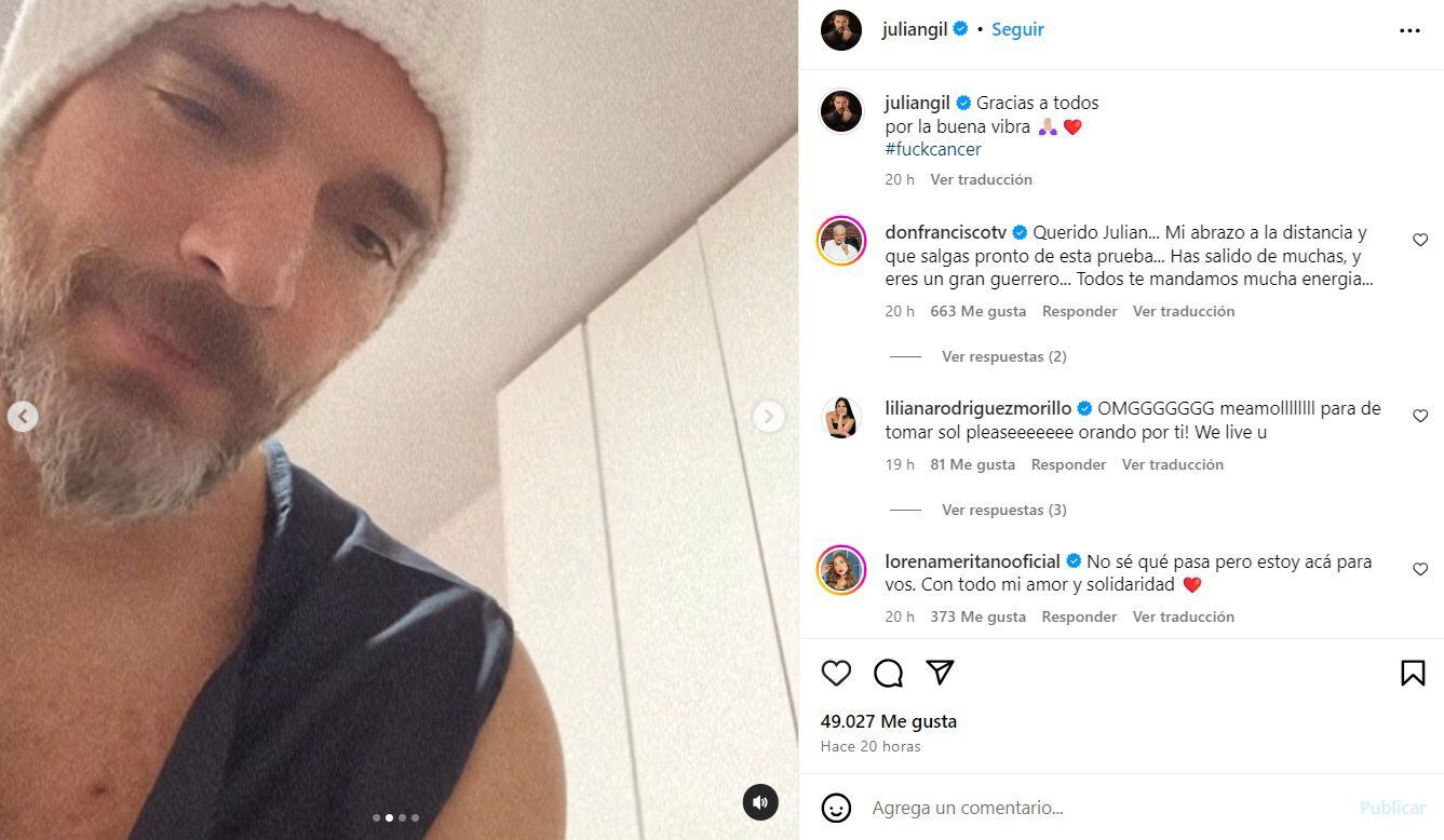 Julián Gil tuvo una nueva aparición de cáncer de piel. (Foto: Instagram @juliangil)
