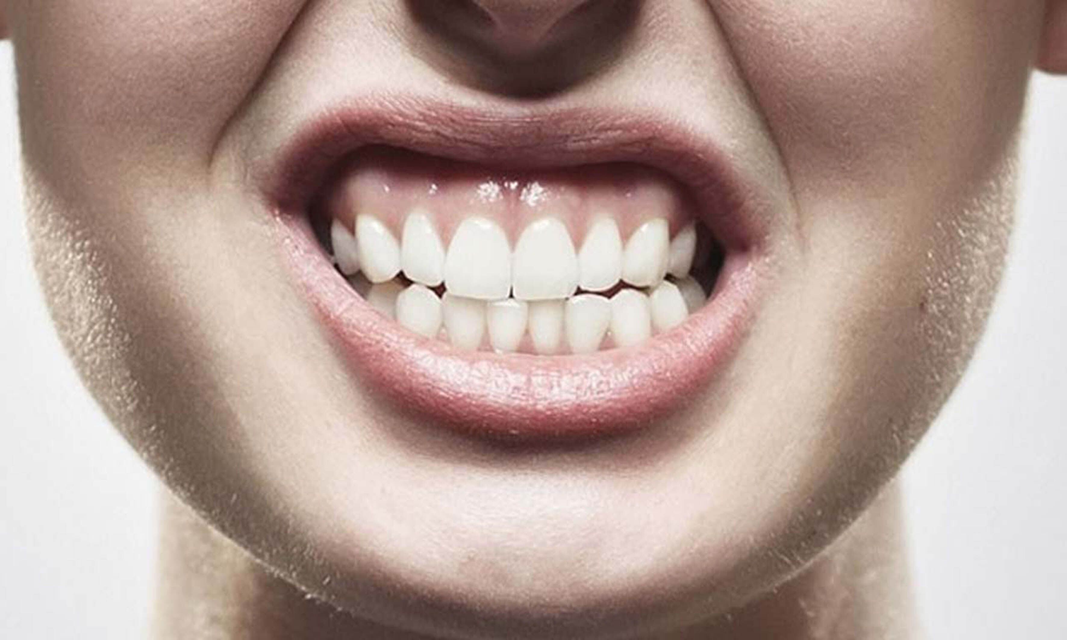 El poder de la mandíbula: el 80% de mexicanos rechinan o aprietan los dientes... y no es nada bueno