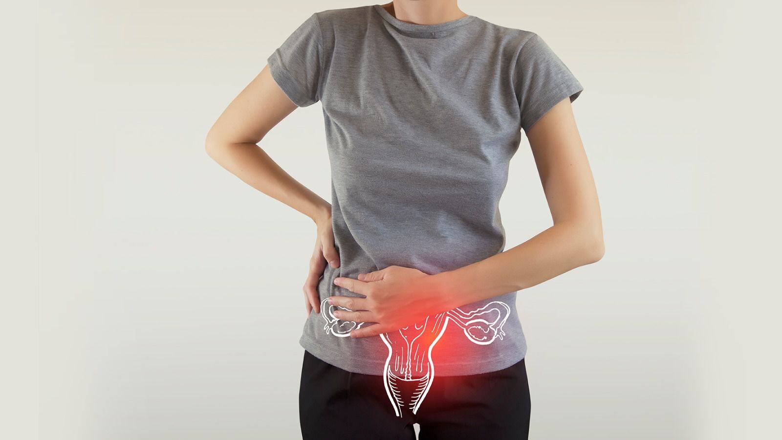 Cáncer de ovario: ¿Qué origina esta enfermedad y cuáles son los síntomas?