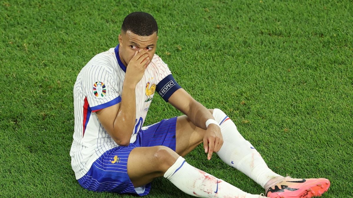 Kylian Mbappé sufrió una fractura en el partido debut de Francia frente a Eslovenia en la Eurocopa 2024, por la que ha tenido que usar mascarilla. (Foto: EFE)