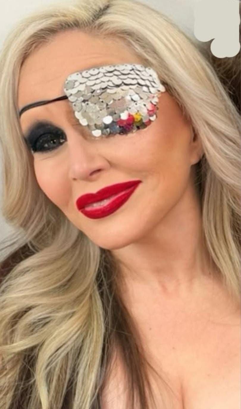 Alaska apareció con un parche en el ojo. (Foto: Instagram @alaskaoficial)