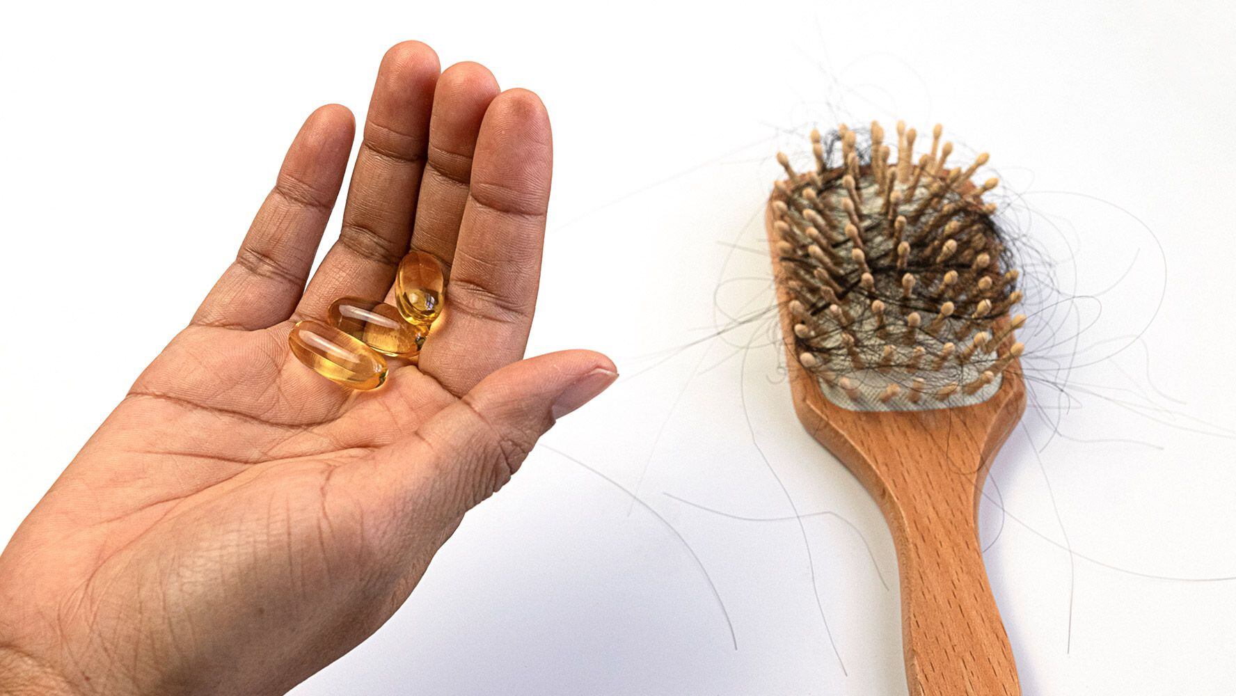 La biotina en suplemento no es más efectiva para evitar la caída del cabello, de acuerdo con varios estudios. (Foto: Shutterstock)