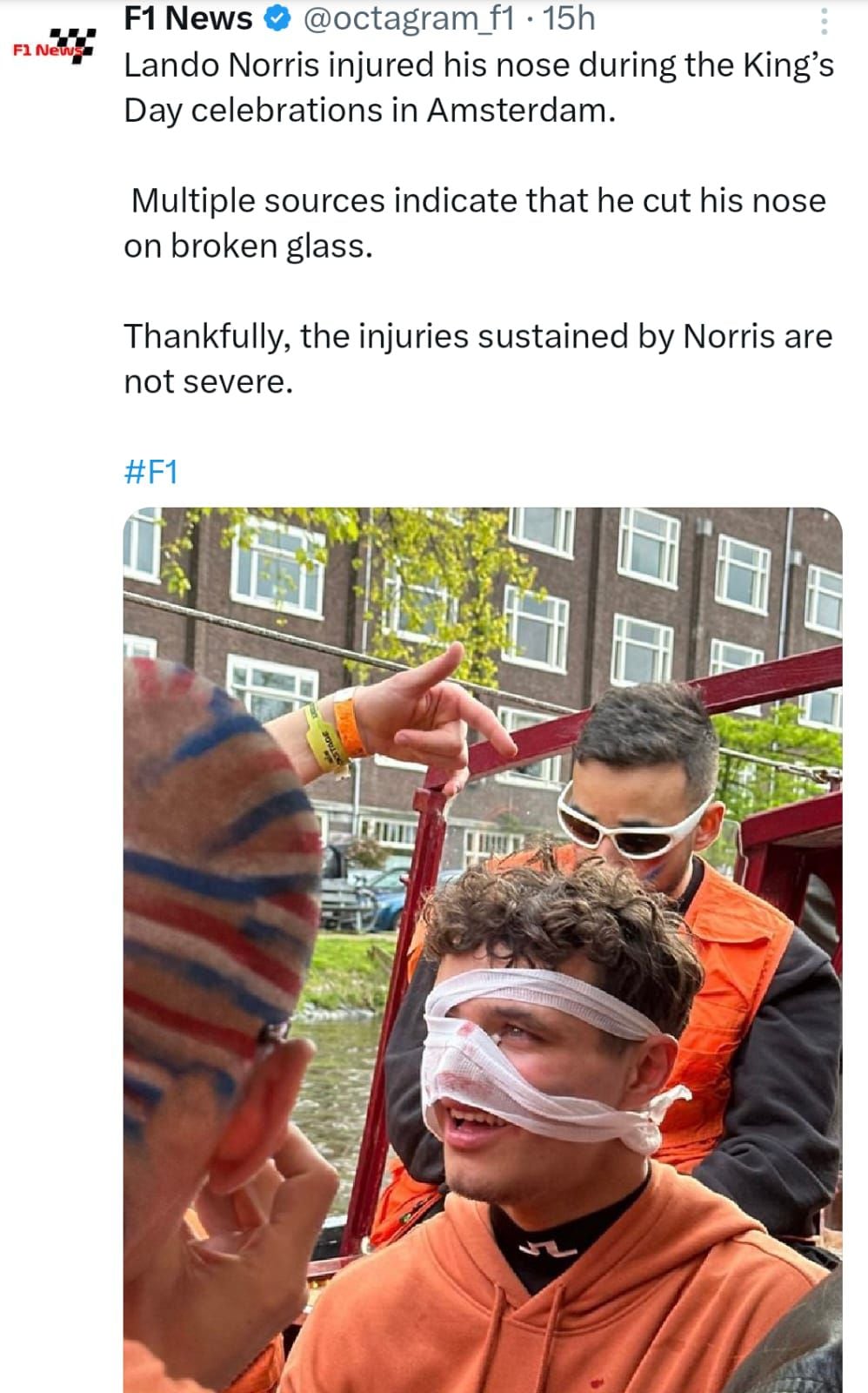 Lando Norris se lastimó la nariz en Países Bajos. (Foto: Captura de pantalla).