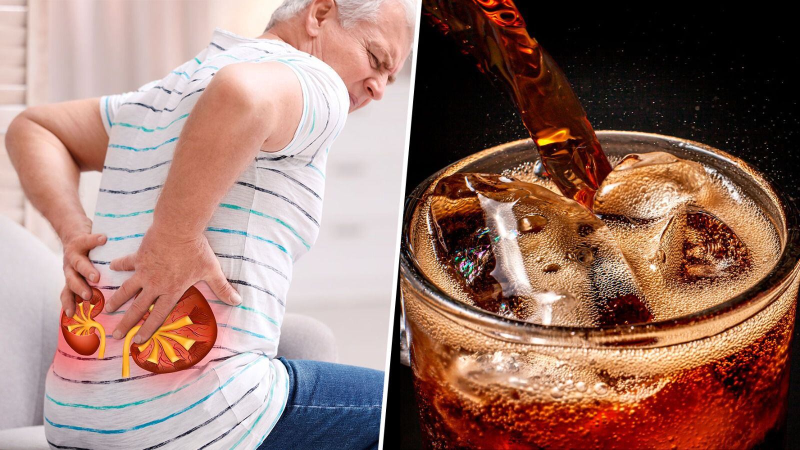 El refresco de cola es uno de los que más daño hace a la salud de los riñones. (Fotos: Shutterstock).
