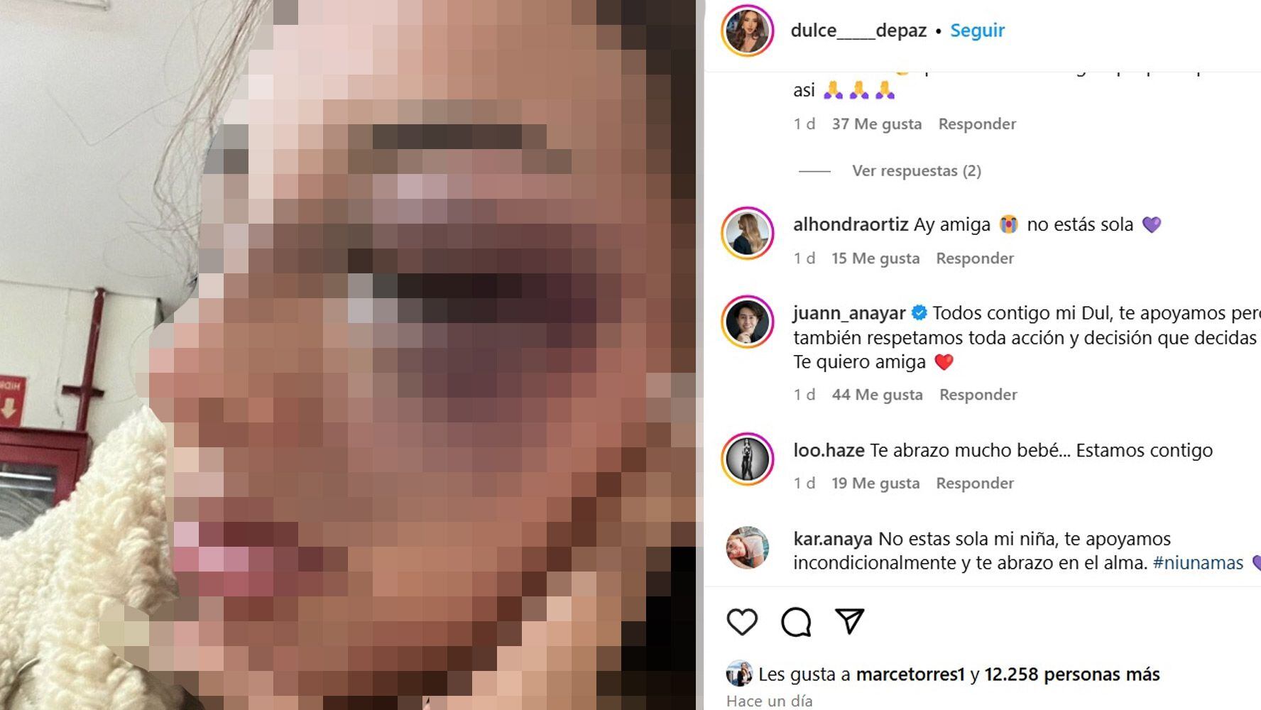 La modelo Dulce Melisa compartió fotos de su rostro, luego de ser agredida por su pareja, y envió un mensaje a sus seguidores.