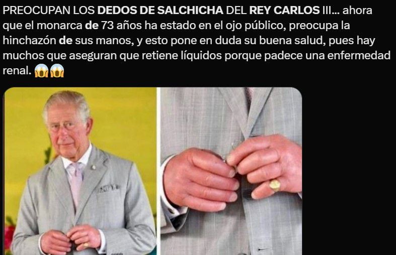 Usuarios de redes sociales cuestionaron los llamados 'dedos de salchicha' del Rey Carlos III. (@CarLon_2020)