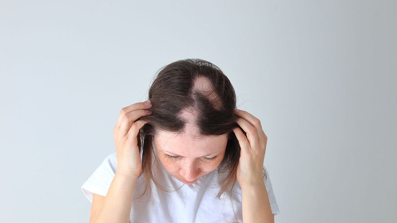 Existe la posibilidad de que la tracción en el cabello provoque alopecia si esto ocurre frecuentemente.