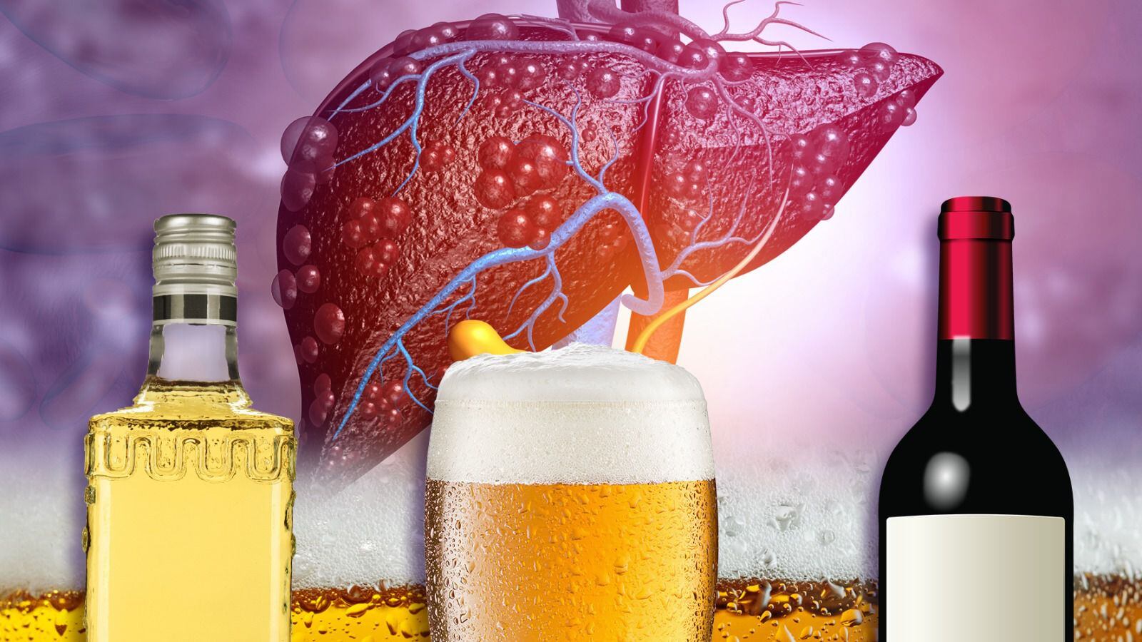 Las bebidas alcohólicas en exceso son de las que más dañan al hígado. 
