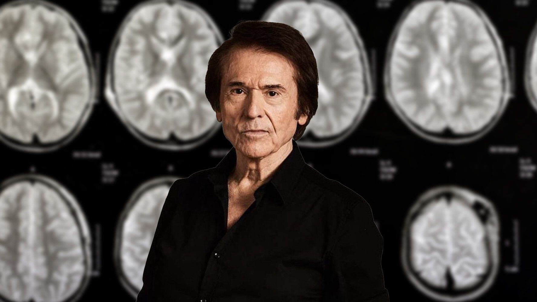 Raphael fue diagnosticado con un linfoma cerebral para el cual comenzará tratamiento. (Fotos: Instagram @raphaelartista / Shutterstock).