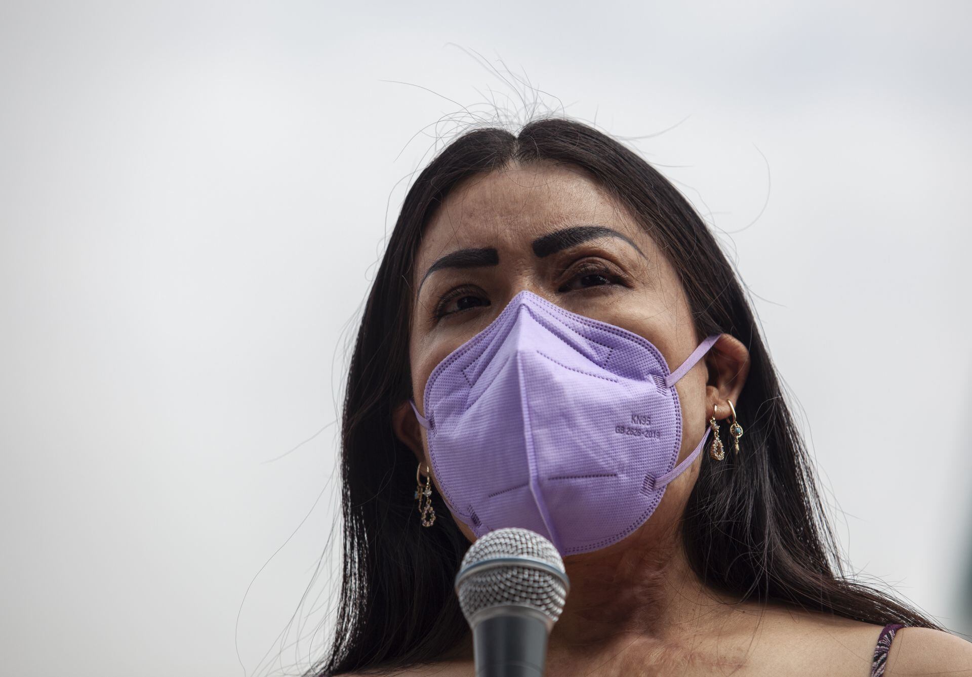 María Elena Ríos ha denunciado la falta de justicia en su caso, luego de sufrir un ataque con ácido.