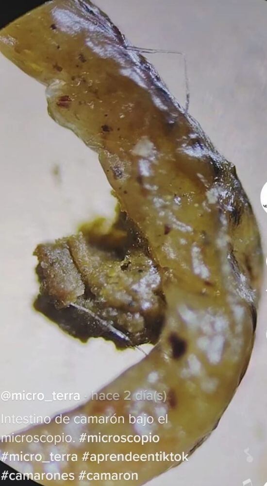 Al verse en un microscopio, la 'vena negra' de los camarones tiene un aspecto parecido a la arena. (Foto: TikTok @micro_terra). 