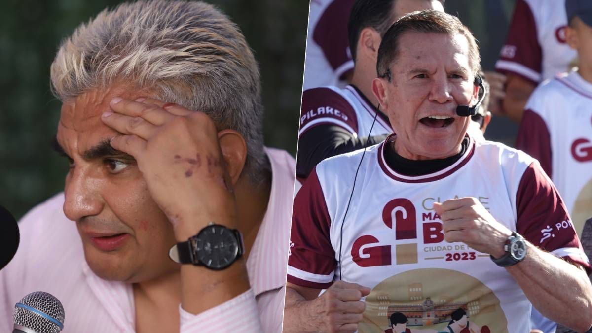 ¿Shocker será ‘mil por ciento guapo’ otra vez? Julio César Chávez le pagaría operación de la mandíbula