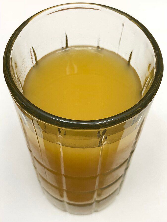 El jugo de piña se asocia con algunos beneficios para el cuerpo por sus propiedades. (Foto: Wikimedia Commons)