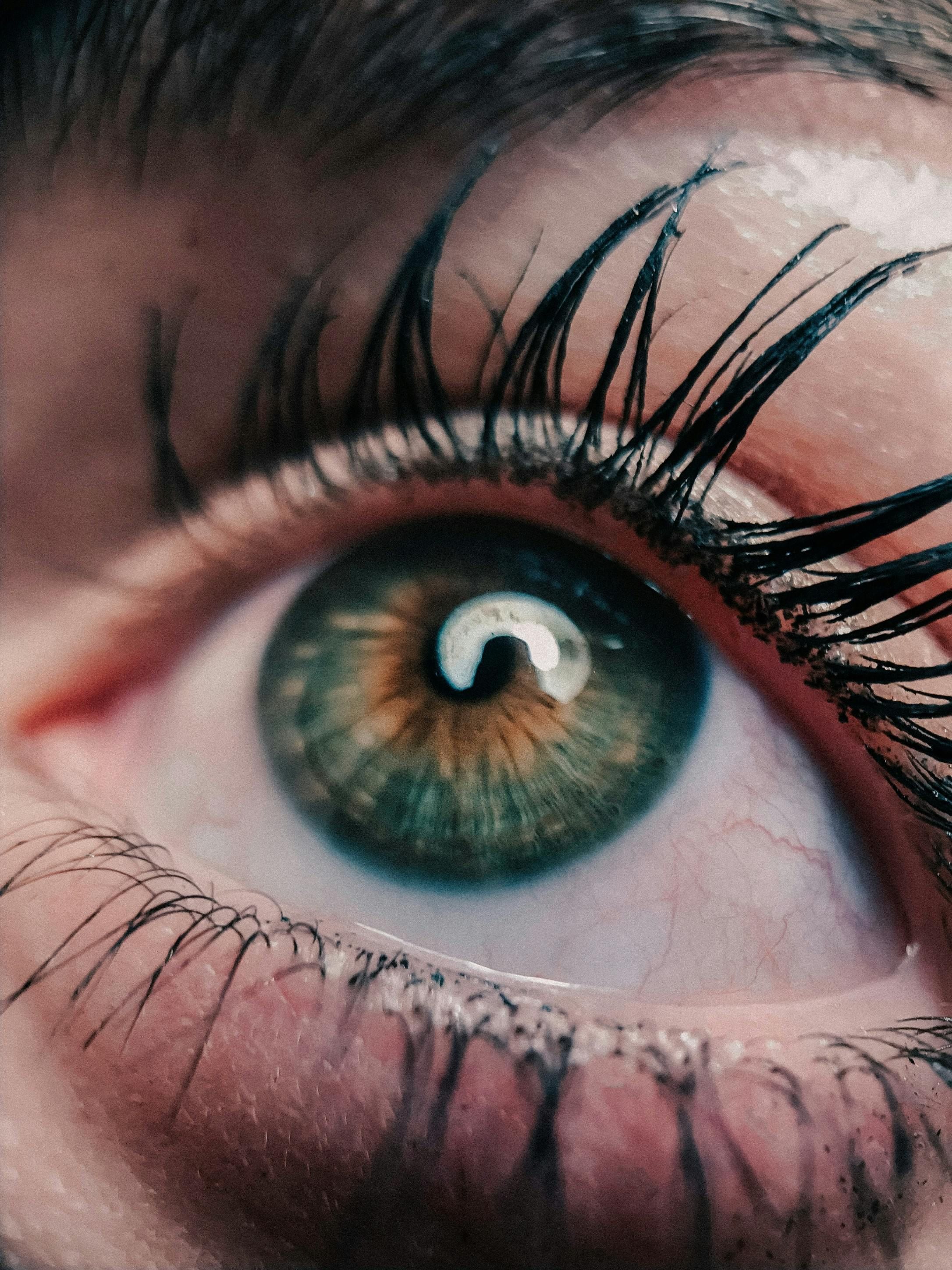 El aceite de ricino podría causar irritación ocular si entra en contacto con los ojos. (Foto: Pexels)