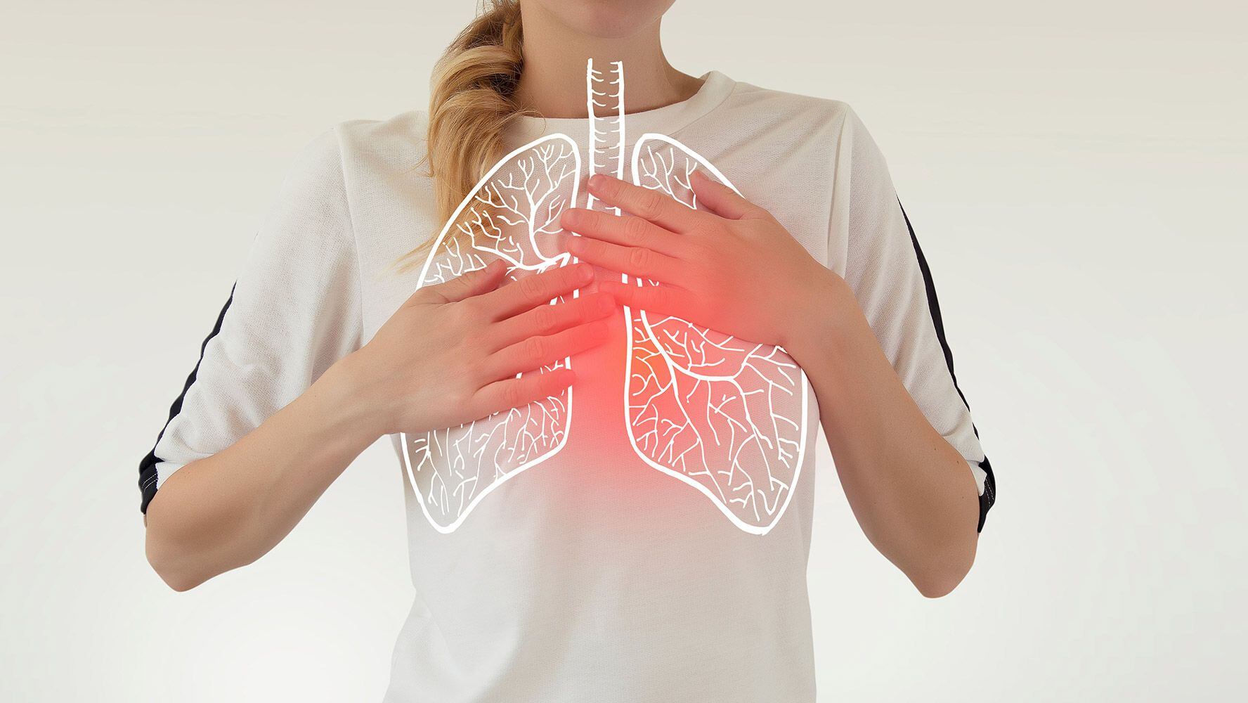 Una trombosis pulmonar puede provocar la muerte si no se atiende a tiempo.